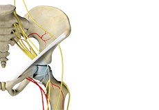 Core Decompression for Avascular Necrosis of the Hip